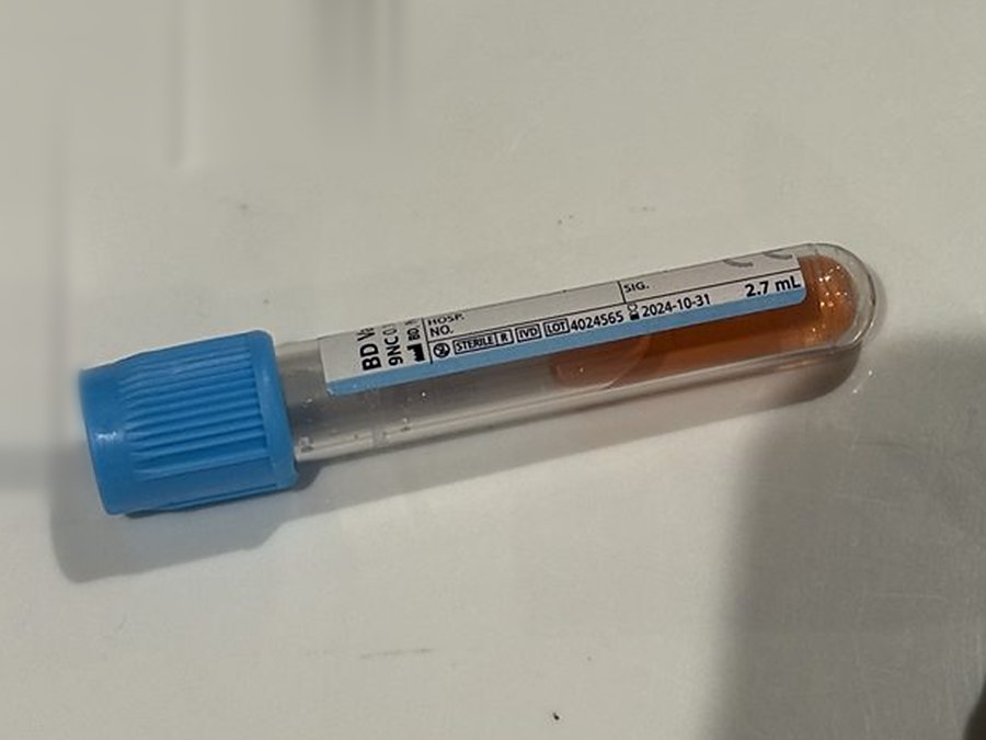 Blood collection tube filled during venepuncture training