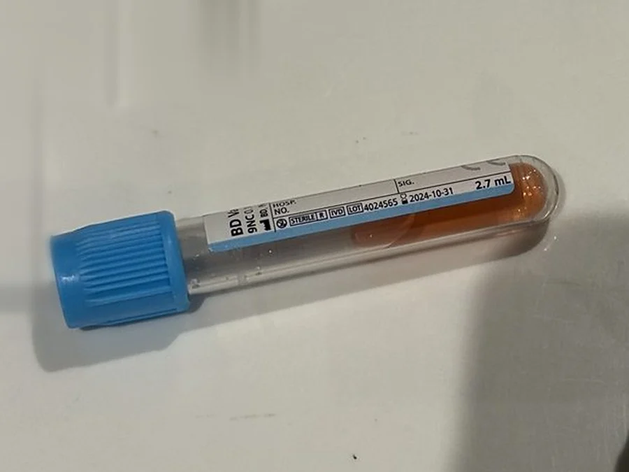Blood collection tube filled during venepuncture training